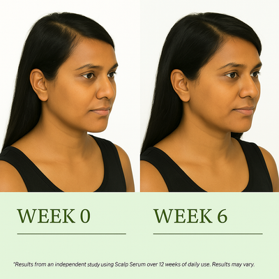 Layered Luxury | Kesya Ayurvedic Hair Root Revival Serum